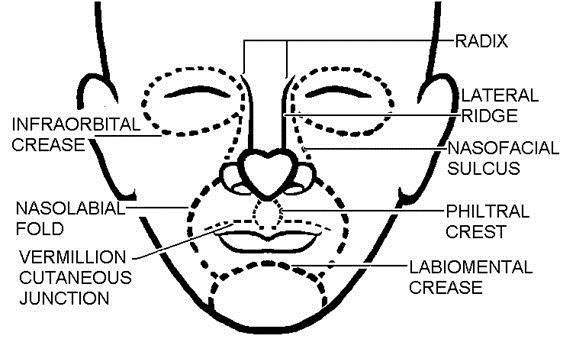 Table 1. Facial aesthetic units (Facial Anatomy in Cutaneous Surgery - Ida Orengo et al)